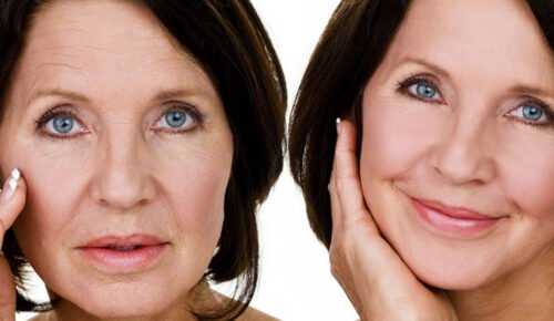 Why-Melbourne-Laser-Clinics-are-the-Best-Choice-for-Anti-Aging-Treatments