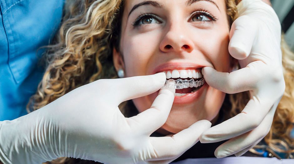 Orthodontic Appliances in Labs